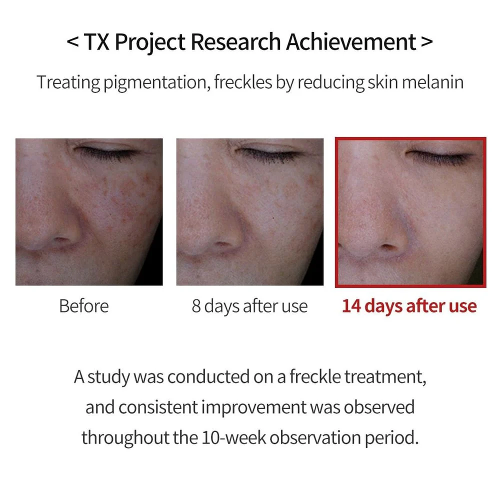 TX Cream -for Dark Spots & Hyperpigmentation - Image 2